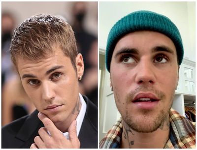 ‘This storm will pass’: Justin Bieber updates fans after Ramsay Hunt syndrome diagnosis