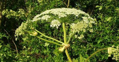 Girl, 4, suffers third-degree burns after touching ‘Britain’s most dangerous plant’
