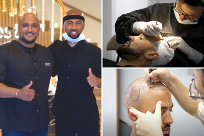 Rangers striker Roofe unveils hair transplant to boost confidence ahead of new season