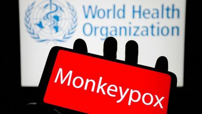 WHO will rename monkeypox virus to combat racism and stigma