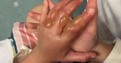 Girl, 4, suffers horrific burns after touching Ireland and the UK's 'most dangerous' plant
