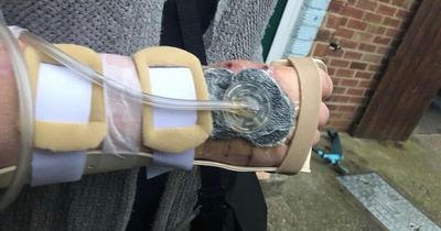 Mum may lose arm as bite from spider in shop-bought fruit won't heal