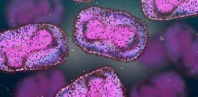 Monkeypox is a DNA virus unlike coronavirus – here's what that means for the virus and us