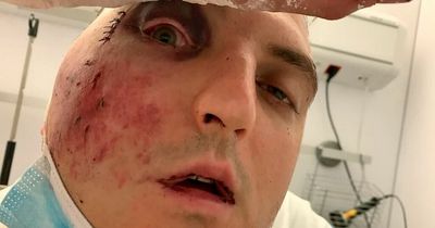 Dad left with fractured skull and broken arms after being thrown off a cliff