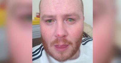 Dad who had acid launched at him felt 'skin turn to jelly' after hitman blinded him for money