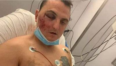 Spain holiday horror: British dad suffers fractured skull after being beaten and thrown off cliff in Salou
