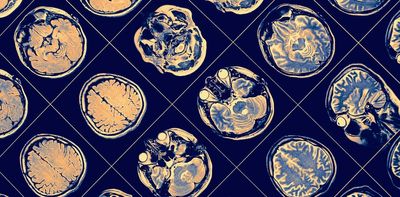 Socially isolated people have differently wired brains and poorer cognition – new research