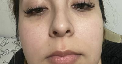Woman nearly loses her eyesight after getting fake eyelashes as a 'treat'