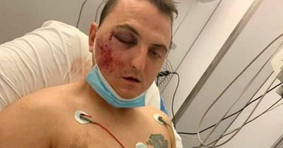 Brit beaten and chucked off cliff by gang on Spanish holiday speaks out from hospital