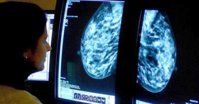 Thousands to benefit after drug is approved for post-surgery breast cancer patients