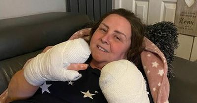 Scots woman has eight fingers amputated after they turned black following mystery illness