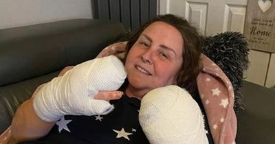 Edinburgh mum has eight fingers amputated after mystery illness turns hands black