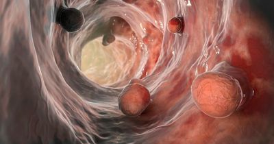 Unusual cancer symptoms - severe night sweats to tiny fingernail spots