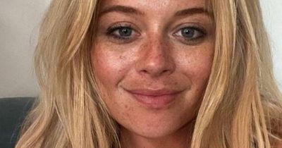 Emily Atack shows off stunning natural freckles after Ibiza holiday transformation