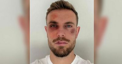 Jordan Henderson shares bruised photo for an important reason