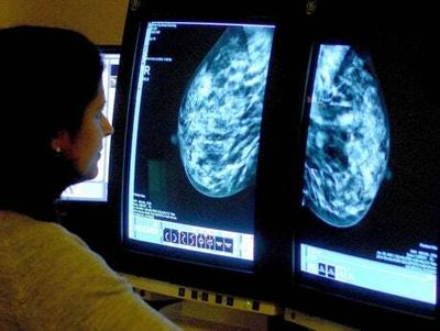 4,000 women with breast cancer could benefit from new pill taken twice a day