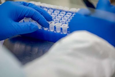 NZ labs need 'systemic' change after PCR testing debacle