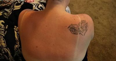 Mum shares 'miracle' shaving cream trick that helps calm sunburn in 30 minutes