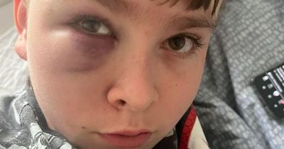 Racist bullies beat boy, 12, pour water on him and try to take his shoes