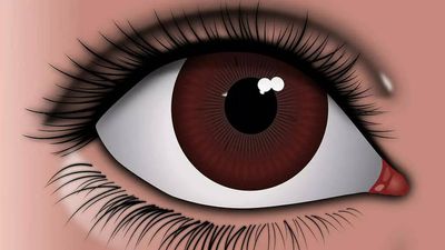 Ranchi Ramgarh: Eye check-up for Ramgarh students