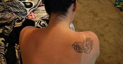 How to 'cure' sunburn in 30 minutes with mum's unusual trick