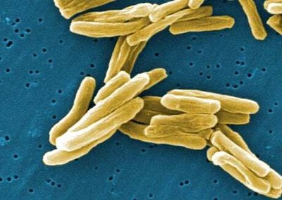 Three people diagnosed with tuberculosis after student dies of disease at Welsh university