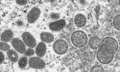 UK monkeypox outbreak not yet under control, say experts