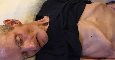 Grandad who was left to starve in care home during covid pandemic became 'skeleton'