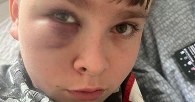 Boy, 12, dreading school after bullies 'beat him and tried to steal his shoes'