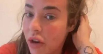 Stephanie Davis suffering from 'painful' condition that has 'distorted' her face