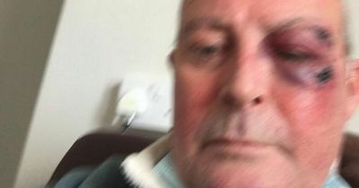 Man, 55, dies just five days after being brutally attacked in park by gang of youths