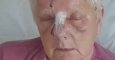 'I thought I was going to die': Pensioner savaged by 'pit bull-type' dog in bloodbath tells of her terror