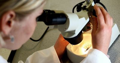 Millions of women missing vital cancer checks