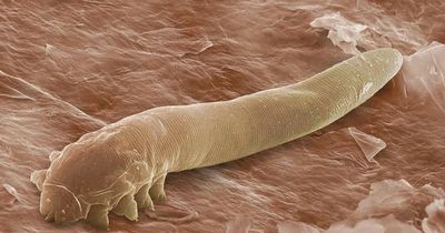 Parasitic mites that have sex on our faces at night could face extinction