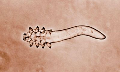 Mites that mate on our faces at night face extinction threat