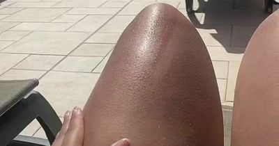 Expert warns against copying 'unsafe' holiday tanning trend this summer