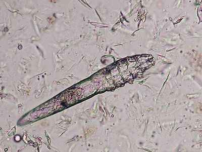 Yes, there are mites living on your face — and they can poop, a new study finds