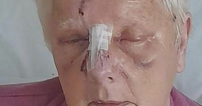 Terrified OAP 'thought she would die' after being attacked by vicious dog