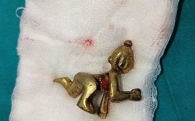 Man swallows tiny idol, undergoes surgery