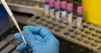 Irish health officials confirm 14 new cases of monkeypox
