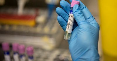 First suspected monkeypox case recorded in Nottinghamshire