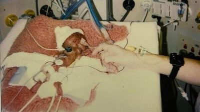 'Coke Can Kid' Jonathon Heeley's survival as Australia's smallest baby was uncertain in 1992. Next week he turns 30