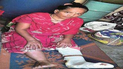 Vadodara: Woman injured as plaster falls on her