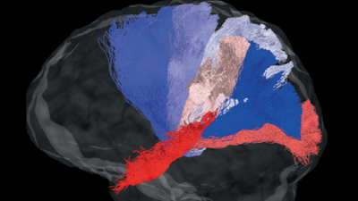 Bengaluru: Machine learning algorithm used to study brain connectivity
