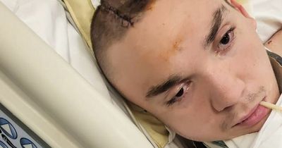 Man left unable to walk or talk after buggy accident on Ayia Napa holiday