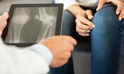 Knee replacements stall in regions of England with weight rules for patients