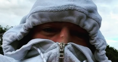 Conor McGregor shows cut nose as he posts bizarre video online