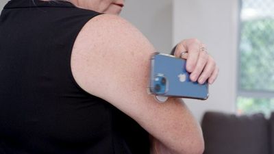 Continuous Glucose Monitoring technology subsidised for Australians with type 1 diabetes