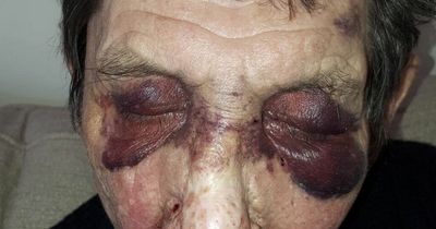 Scots OAP suffers horrific injuries after being 'beaten up and stabbed' in his own home