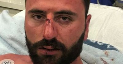 Manchester man left covered in blood and with horrific injuries in Ibiza gets £58,000 payout
